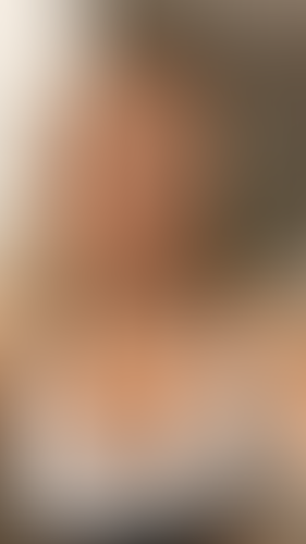 Geblurrte Content-Vorschau