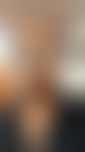 Geblurrte Content-Vorschau