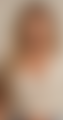 Geblurrte Content-Vorschau