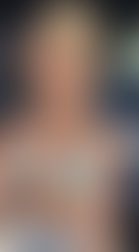 Geblurrte Content-Vorschau