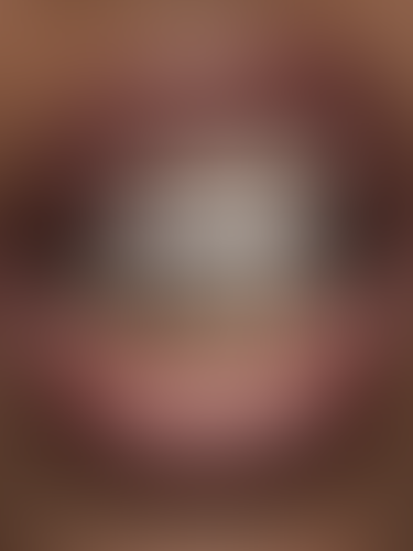 Geblurrte Content-Vorschau