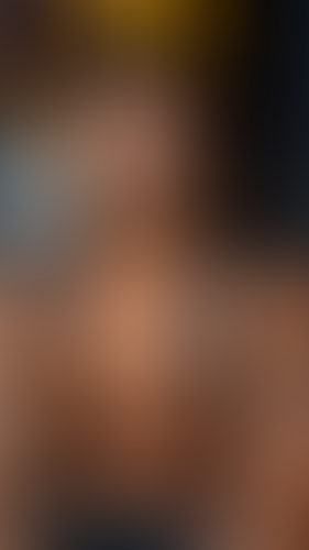 Geblurrte Content-Vorschau