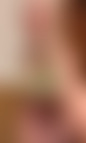 Geblurrte Content-Vorschau
