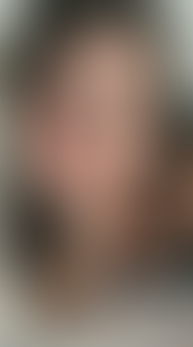 Geblurrte Content-Vorschau