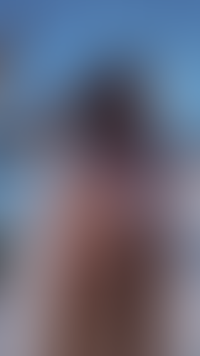 Geblurrte Content-Vorschau