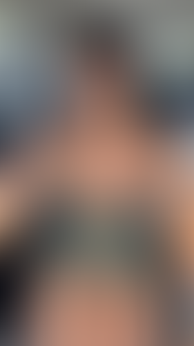Geblurrte Content-Vorschau