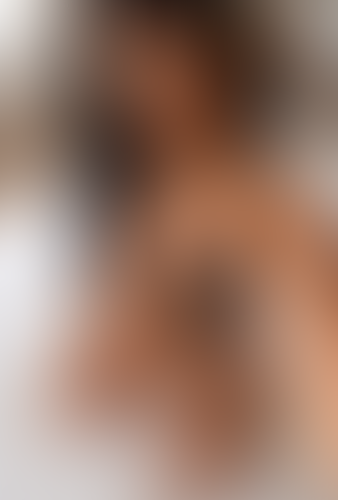 Geblurrte Content-Vorschau