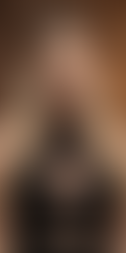 Geblurrte Content-Vorschau