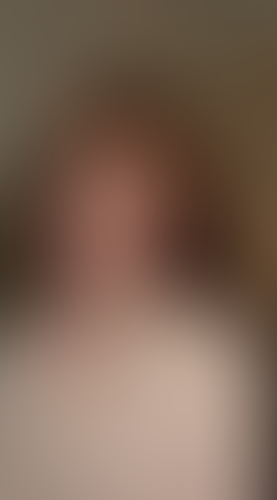 Geblurrte Content-Vorschau