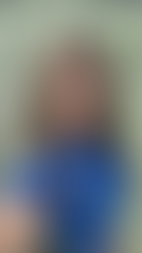 Geblurrte Content-Vorschau