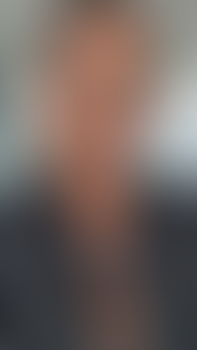 Geblurrte Content-Vorschau