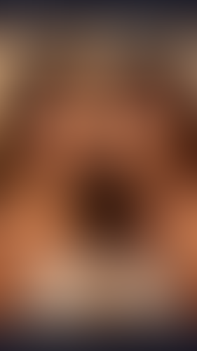 Geblurrte Content-Vorschau