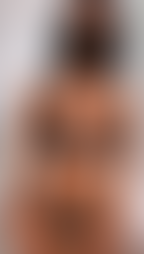 Geblurrte Content-Vorschau