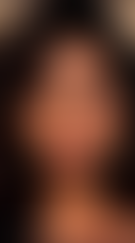 Geblurrte Content-Vorschau