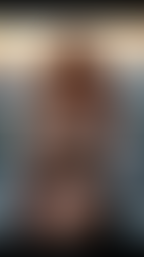 Geblurrte Content-Vorschau