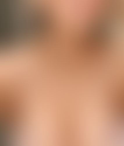 Geblurrte Content-Vorschau