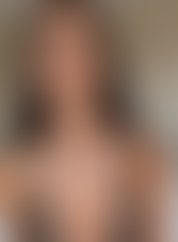 Geblurrte Content-Vorschau