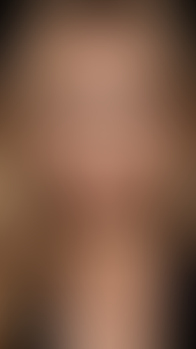 Geblurrte Content-Vorschau