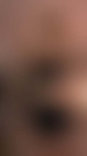 Geblurrte Content-Vorschau