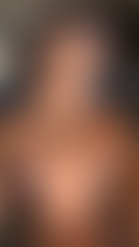 Geblurrte Content-Vorschau