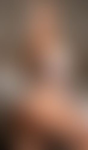Geblurrte Content-Vorschau