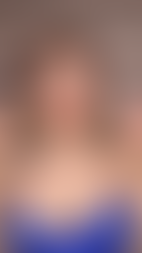 Geblurrte Content-Vorschau