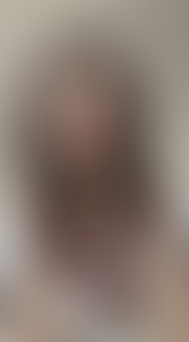 Geblurrte Content-Vorschau