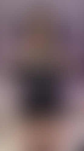 Geblurrte Content-Vorschau