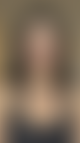 Geblurrte Content-Vorschau