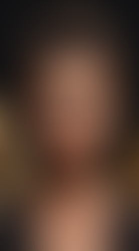Geblurrte Content-Vorschau
