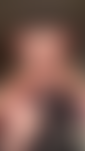 Geblurrte Content-Vorschau