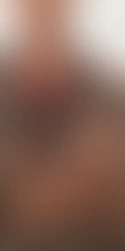 Geblurrte Content-Vorschau