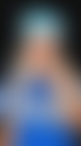 Geblurrte Content-Vorschau