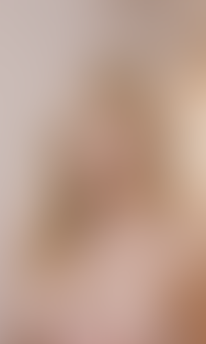 Geblurrte Content-Vorschau