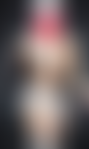 Geblurrte Content-Vorschau