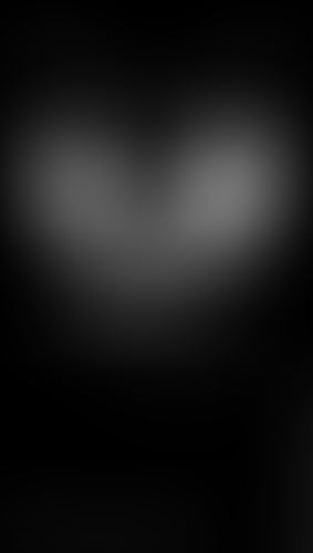 Geblurrte Content-Vorschau