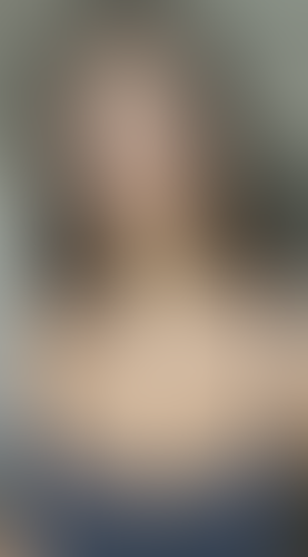 Geblurrte Content-Vorschau