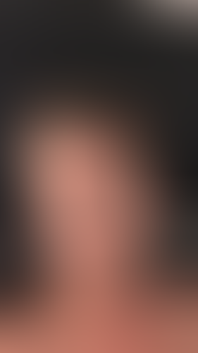 Geblurrte Content-Vorschau