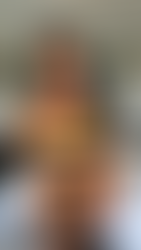Geblurrte Content-Vorschau