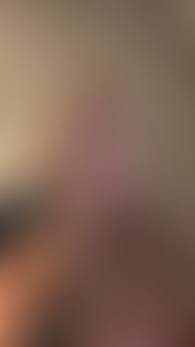 Geblurrte Content-Vorschau