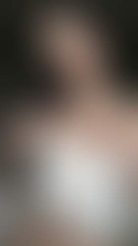 Geblurrte Content-Vorschau