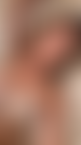 Geblurrte Content-Vorschau
