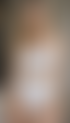 Geblurrte Content-Vorschau