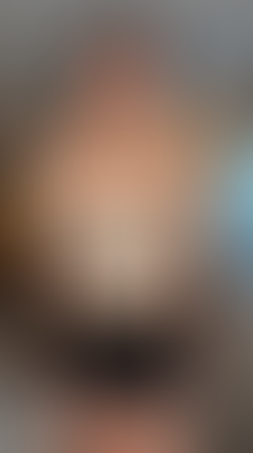 Geblurrte Content-Vorschau