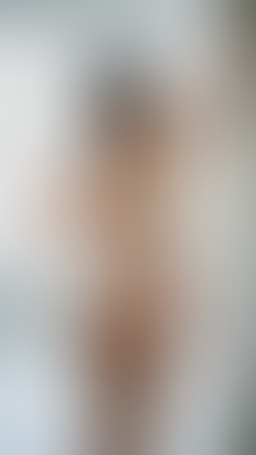 Geblurrte Content-Vorschau
