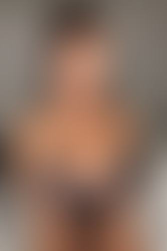 Geblurrte Content-Vorschau