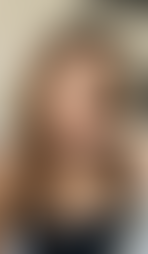 Geblurrte Content-Vorschau
