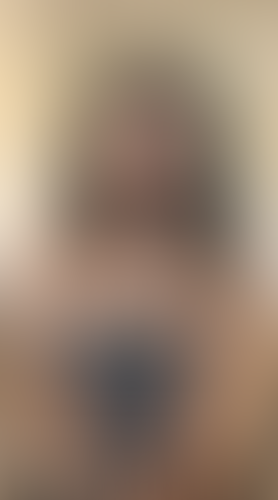 Geblurrte Content-Vorschau