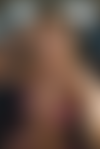 Geblurrte Content-Vorschau